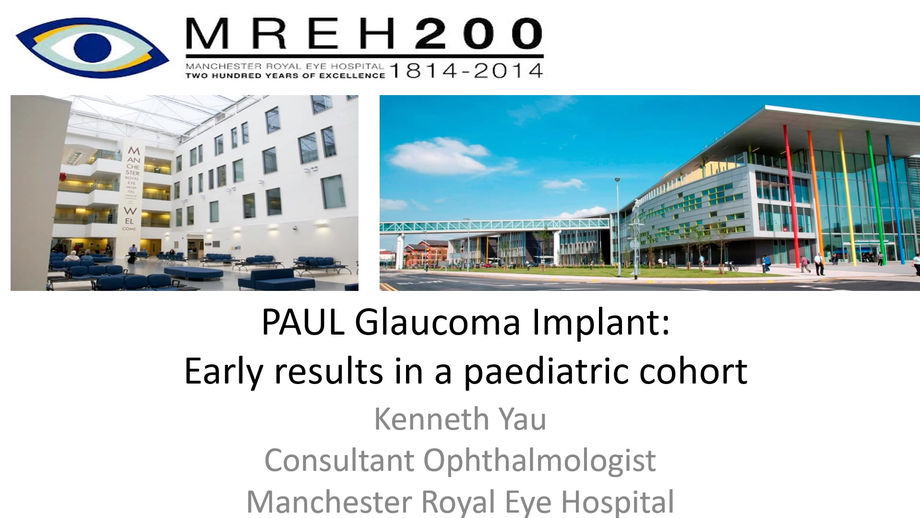 4 - Kenneth Yau - The PAUL Glaucoma Implant: Early results in a paediatric cohort